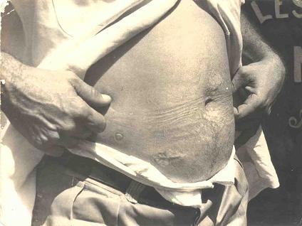 Dos proyectiles le hab�an atravesado de lado a lado el est�mago, pero no le afect� ning�n �rgano vital